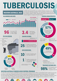 Tuberculosis snapshot 2021